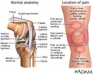 When My Knees Finally Gave In: A Personal Journey