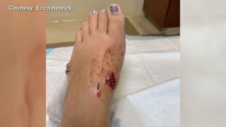 Young Shark Bites Woman at New York Beach, Officials Say
